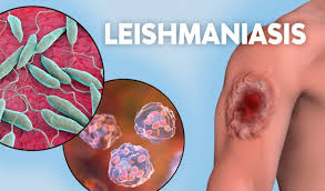 La leishmaniasis: una enfermedad olvidada que amenaza a millones